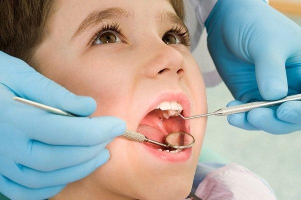 علت افزایش پوسیدگی دندان ایرانی ها، دومین بیماری عفونی شایع