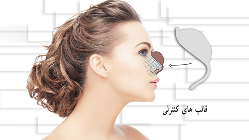 مهندسی جراحی بینی؛ این علم نوین را بشناسید! مهندسی جراحی بینی؛ این علم نوین را بشناسید!